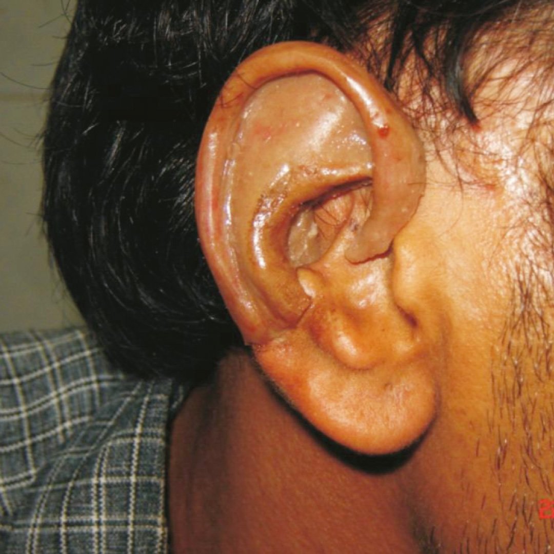 Ear_1