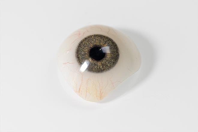 Eye Prosthesis (Ocular Prosthesis)
