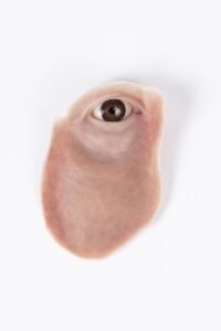 Silicone Facial Prosthesis