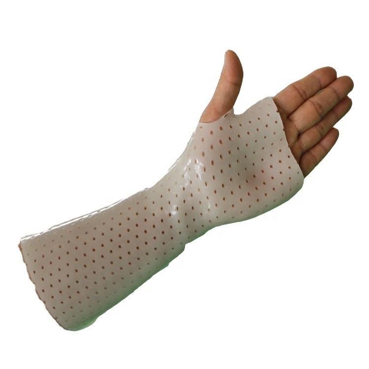 Splints